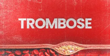 Trombose: informação ajuda a reconhecer fatores de risco e sinais de alerta